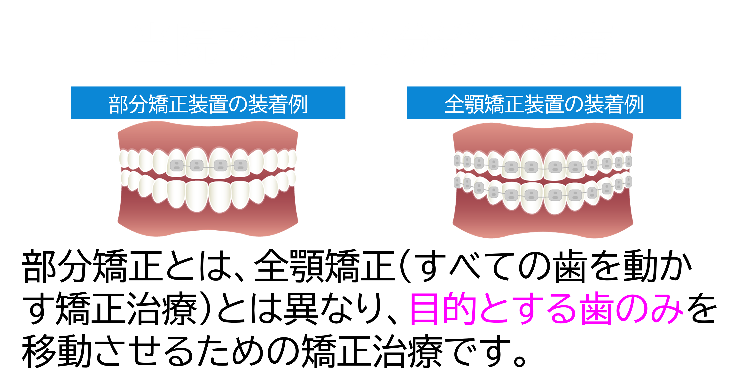 予防歯科